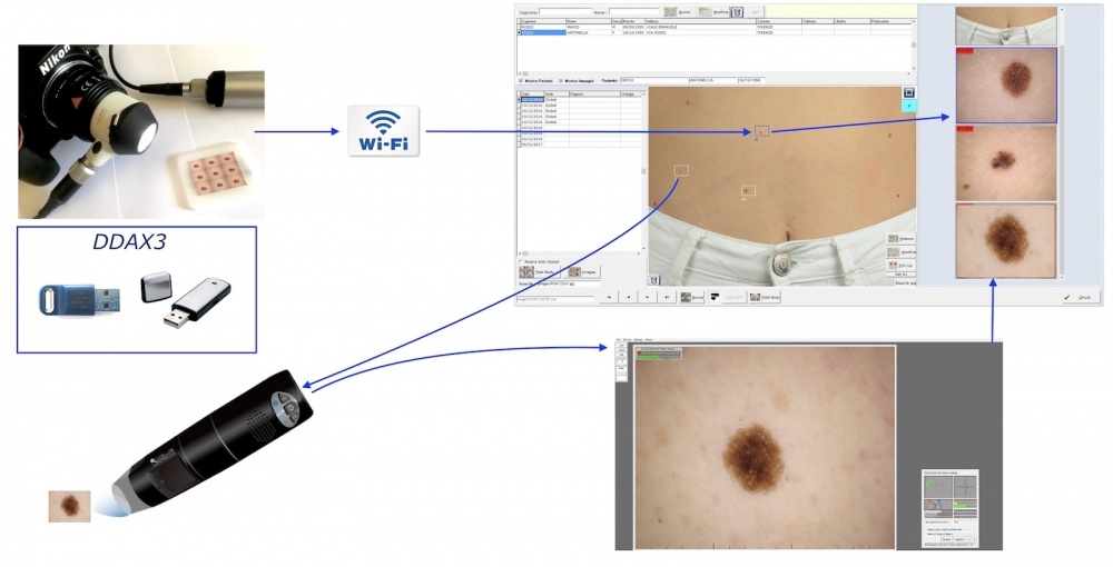Software autoinstallante e dermatoscopi - Software DDAX3 e Video Dermatoscopi HD Dell'Eva-Burroni